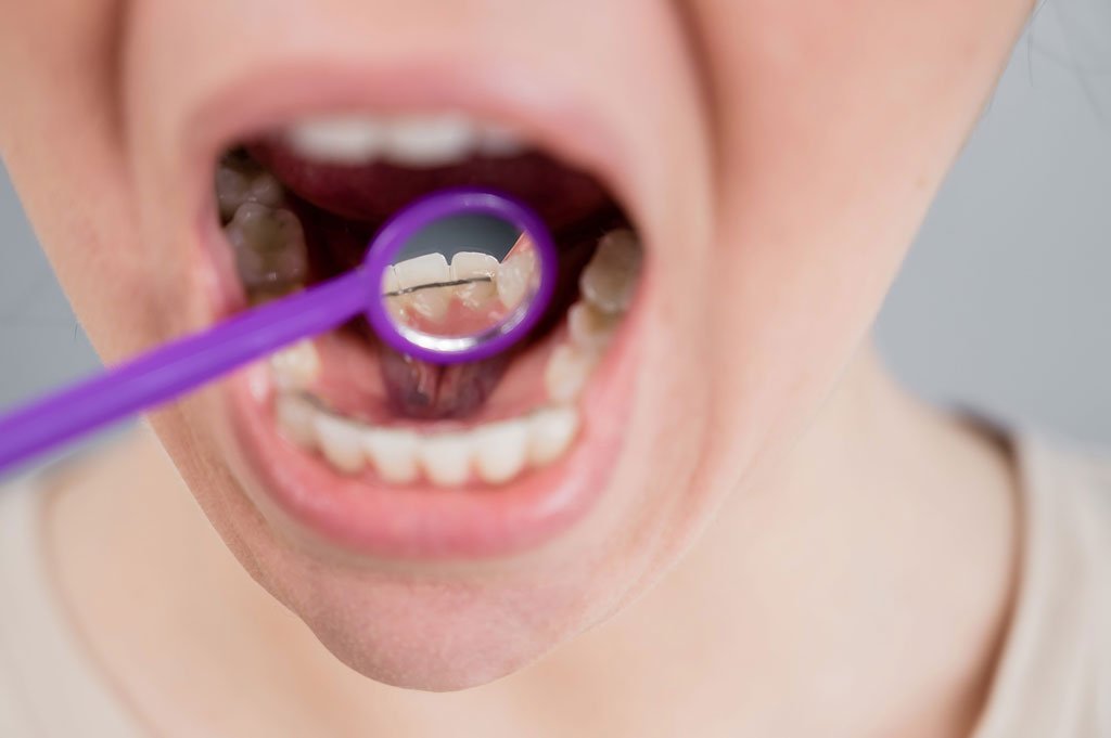 role of oral health professionals HPV-related cancer